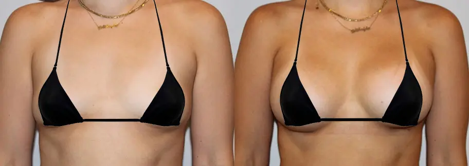 Before & After Photo