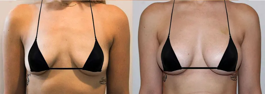 Before & After Photo