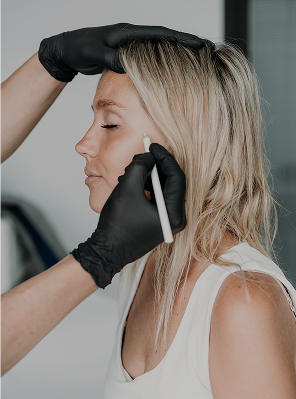 A close-up profile shot of a blonde woman receiving an aesthetic procedure. A person wearing black gloves is holding a white marking pencil and making a mark on the side of her face near her cheekbone. The woman has her eyes closed and a calm expression. The background is bright and slightly blurred.