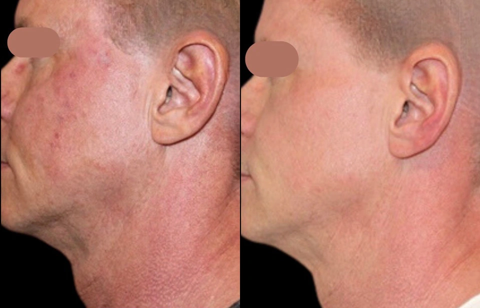 Before and After Plastic Surgery Results | CraftMD Scottsdale & Phoenix, AZ