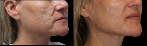 Before and After Plastic Surgery Results | CraftMD Scottsdale & Phoenix, AZ