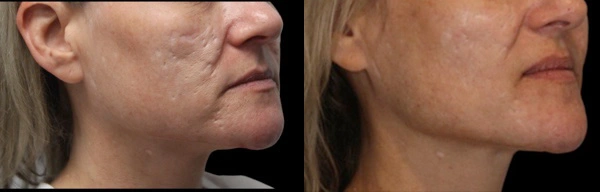 Before and After Plastic Surgery Results | CraftMD Scottsdale & Phoenix, AZ