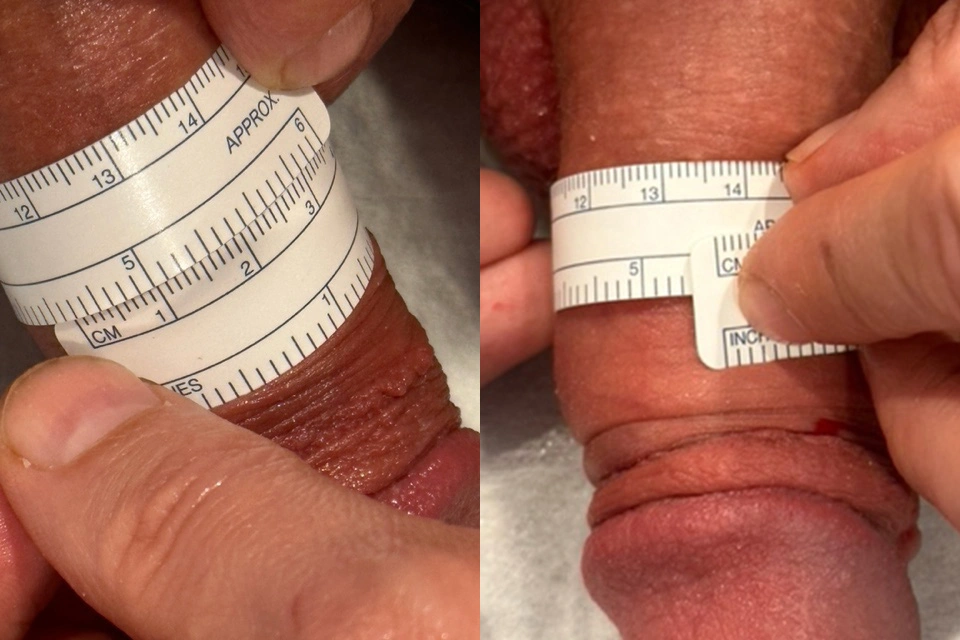 Before and After Plastic Surgery Results | CraftMD Scottsdale & Phoenix, AZ