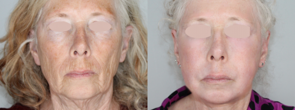 Untitled design (10)