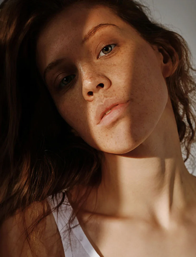 A vertical, close-up portrait of a young woman with reddish-brown hair and freckles, looking directly at the camera. Her face is dramatically lit by a single beam of sunlight that casts a sharp diagonal shadow across her nose and cheek, highlighting her features. She is wearing a white tank top. - Aerolase in Phoenix, AZ