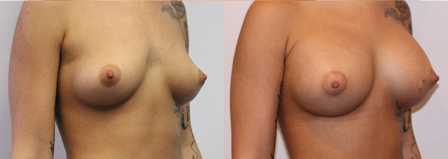 5828-breastaug-p11-2