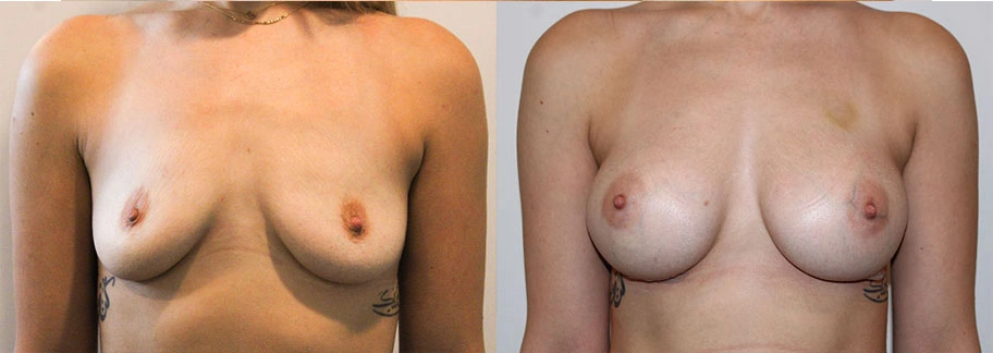 5829-breastaug-p12-1