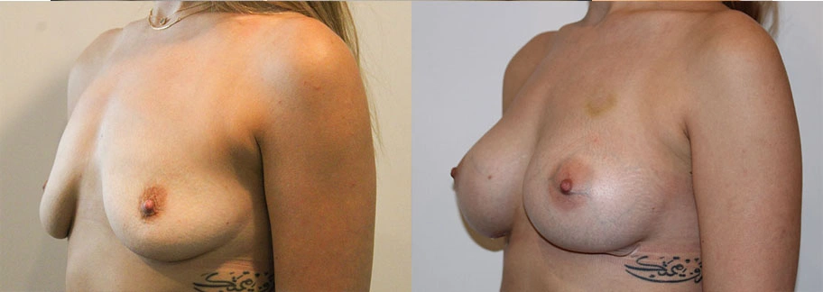 5831-breastaug-p12-2