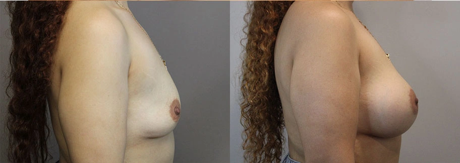 5834-breastaug-p13-2