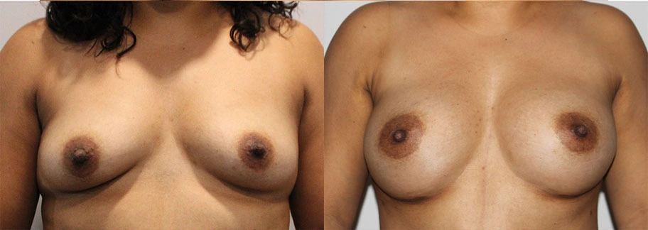 5835-breastaug-p14-1