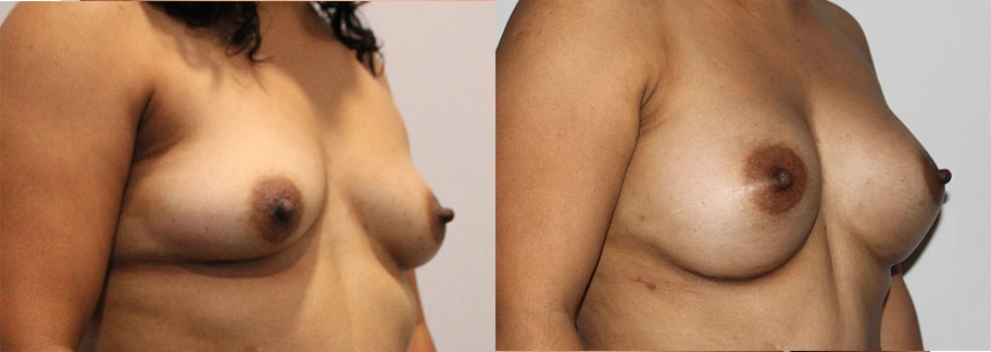 5837-breastaug-p14-2