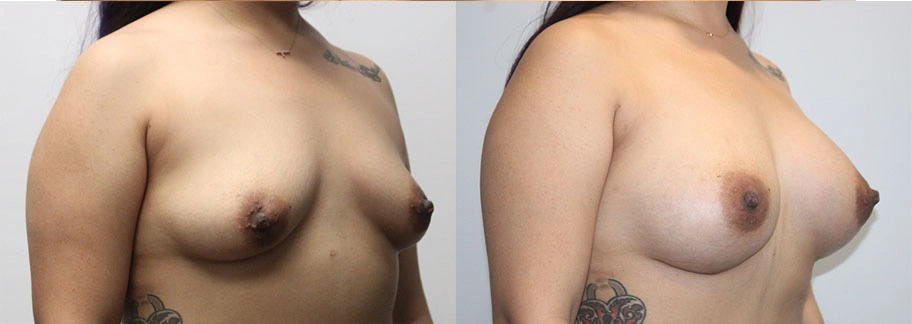 5841-breastaug-p16-1