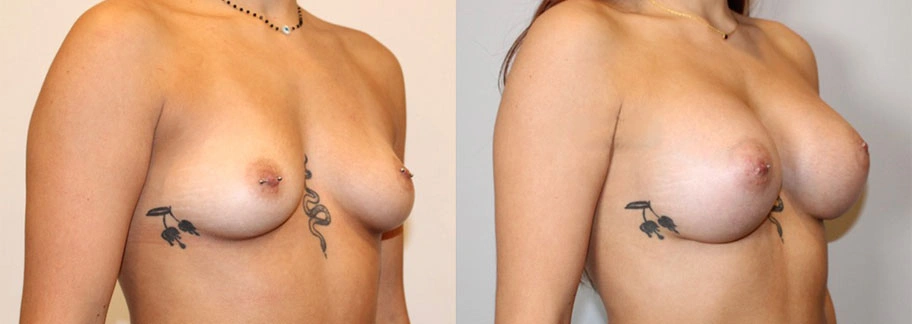 5854-breastaug-p22-1