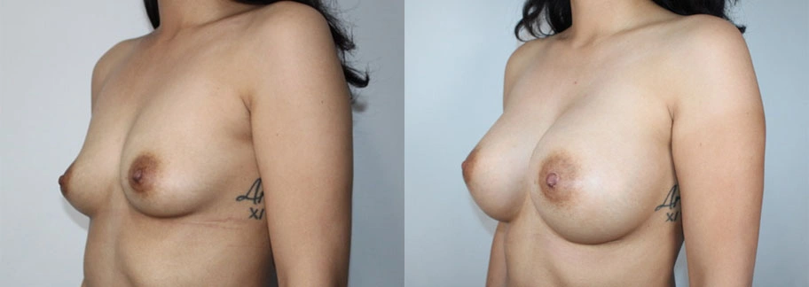 5886-breastaug-p31-2