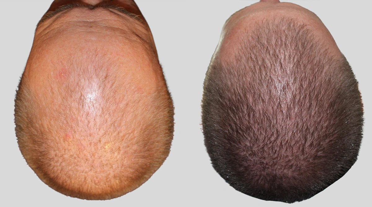 Before and After Plastic Surgery Results | CraftMD Scottsdale & Phoenix, AZ