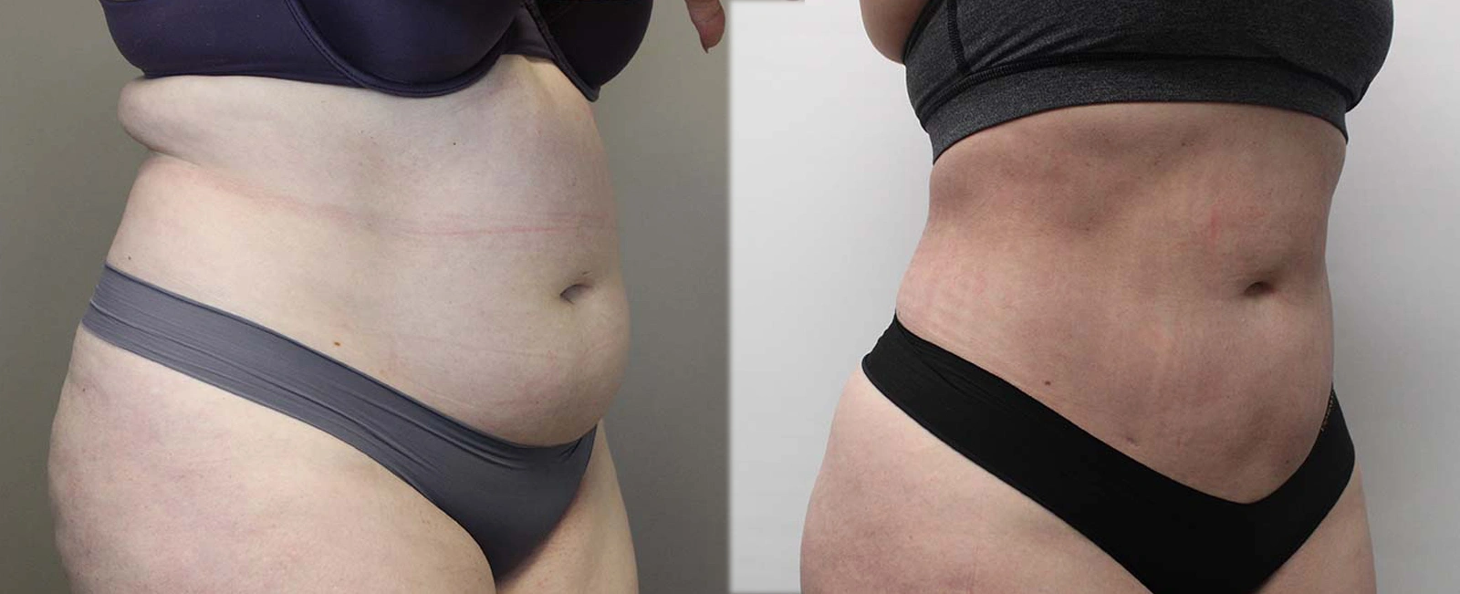 6020-lipo-p02-2