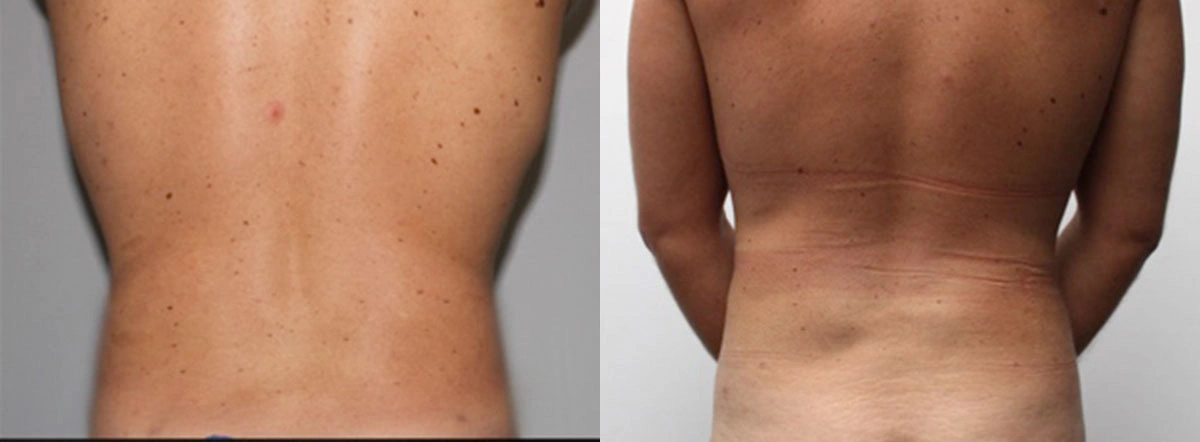 Before and After Plastic Surgery Results | CraftMD Scottsdale & Phoenix, AZ