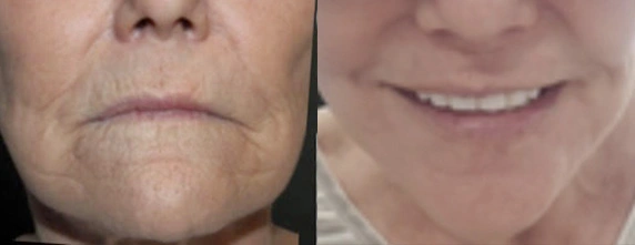 Before and After Plastic Surgery Results | CraftMD Scottsdale & Phoenix, AZ