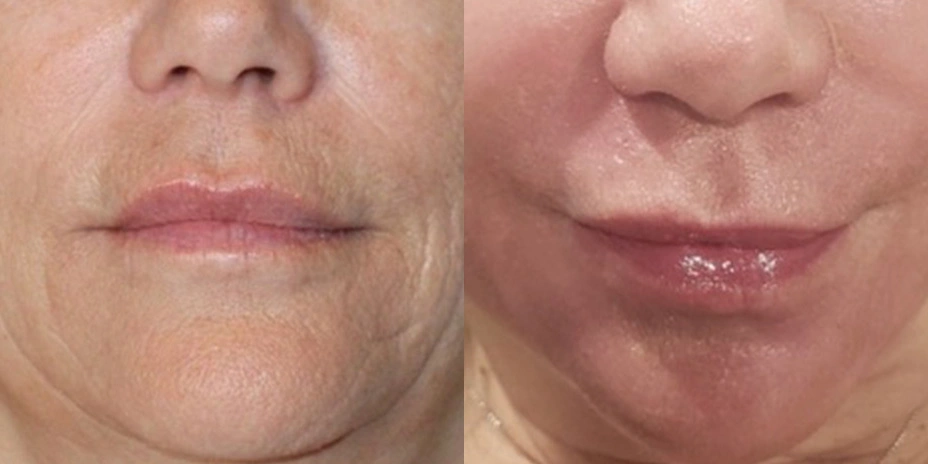 Before and After Plastic Surgery Results | CraftMD Scottsdale & Phoenix, AZ