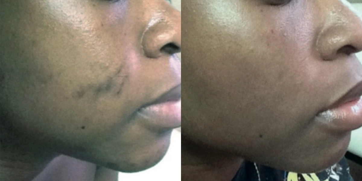 6414-scare-treat-p01-1-1