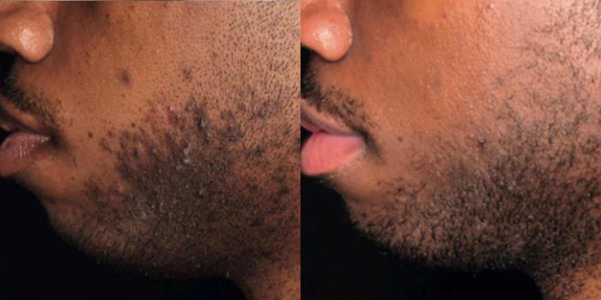 6415-scare-treat-p02-1-1