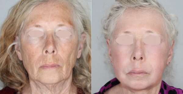 Untitled design (11)